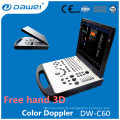 DW-C60 2d Echo Maschine Preis, Laptop Farbe Dopplerson Ultraschall Preis